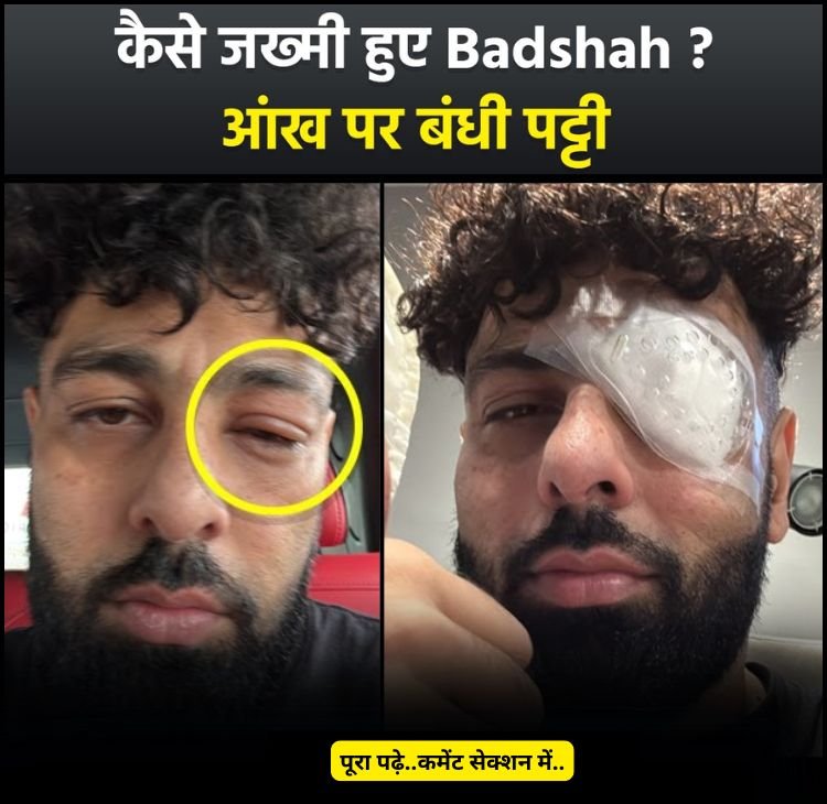 badshah eye